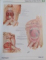 ATLAS OF HUMAN ANATOMY de FRANK H. NETTER