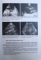 RADIOLOGIE SI IMAGISTICA MEDICALA, MANUAL PENTRU INCEPATORI de S.A. GEORGESCU, C. ZAHARIA , 2003 *PREZINTA SUBLINIERI IN TEXT