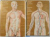 HUMAN ANATOMY , VOL I-II ,  by M.PRIVES, N. LYSENKOV , V. BUSHKOVICH 1985