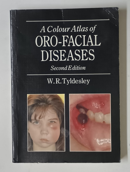 A COLOUR ATLAS OF ORO - FACIAL DISEASES by W.R. TYLDESLEY , 1991
