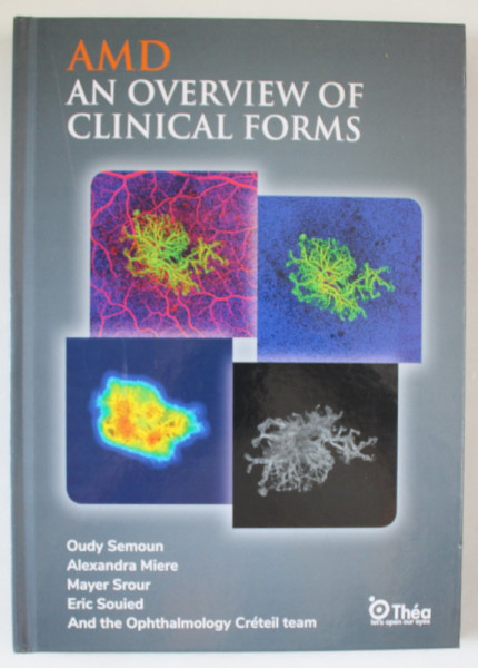 AMD AN OVERVIEW OF CLINICAL FORMS by OUDY SEMOUN  ...THE OPHTHALMOLOGY CRETEIL TEAM , ANII  '2000