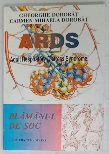 ARDS , ADULT RESPIRATORY DISTRESS SYNDROME , PLAMANUL DE SOC de GHEORGHE DOROBAT si CARMEN MIHAELA DOROBAT , TEXT IN LIMBA ROMANA ,1999 , DEDICATIE *