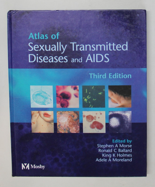 ATLAS OF SEXUALLY TRANSMITTED DISEAS AND AIDS , edited by STEPHEN A. MORSE ...ADELE A. MORELAND , 2004