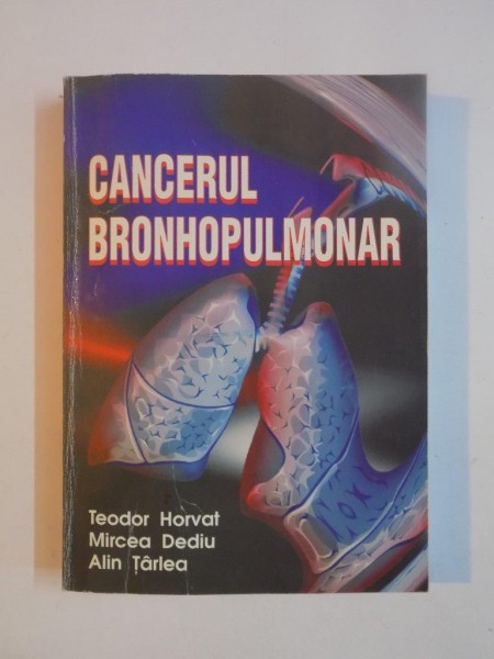 CANCERUL BRONHOPULMONAR de TEODOR HORVAT , MIRCEA DELIU , ALIN TARLEA , 2000