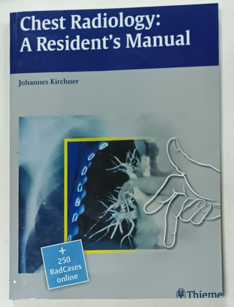 CHEST RADIOLOGY : A RESIDENT 'S  MANUAL by JOHANNES KIRCHNER , + 250 RADCASES ONLINE , 630 ILLUSTRATIONS , 15 TABLES , 2011