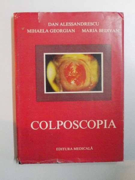 COLPOSCOPIA de DAN ALESSANDRESCU , MIHAELA GEORGIAN , MARIA BEDIVAN , 1984