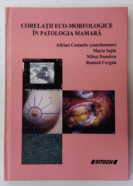 CORELATII ECO - MORFOLOGICE IN PATOLOGIA MAMARA , coordonator ADRIAN COSTACHE ...ROMICA  CERGAN , 2014