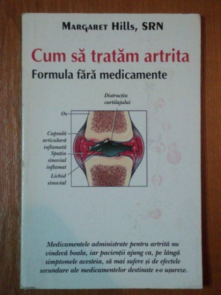 CUM SA TRATAM ARTRITA.FORMULA FARA MEDICAMENTE - MARGARET HILLS  2007