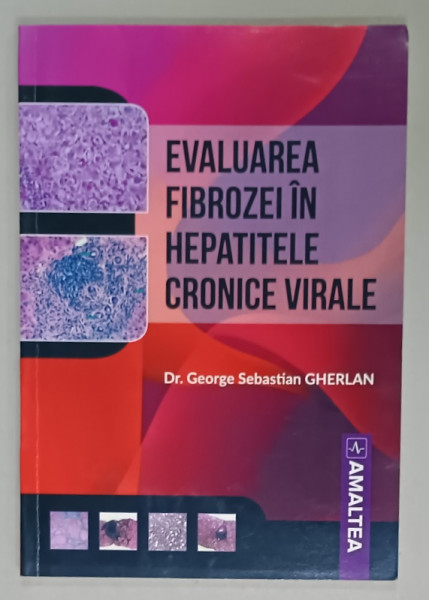 EVALUAREA  FIBROZEI IN HEPATITELE CRONICE VIRALE de Dr. GEORGE SEBASTIAN GHERLAN , 2018