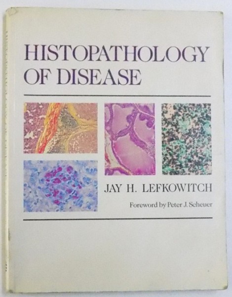 HISTOPATOLOGY OF DISEASE by JAY H. LEFKOWITCH , illustrated by the autor , 1989