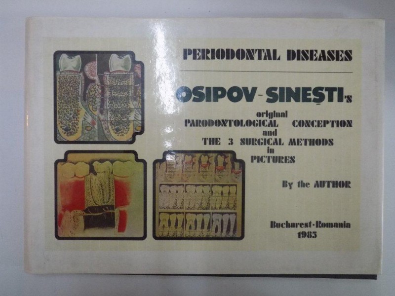 PERIODONTAL DISEASES. OSIPOV - SINESTI'S ORIGINAL PARODONTOLOGICAL CONCEPTION AND THE 3 SURGICAL METHODS IN PICTURES by THE AUTHOR  1985