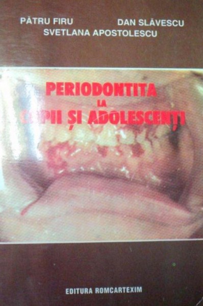 PERIODONTITA LA COPII SI ADOLESCENTI , 1998