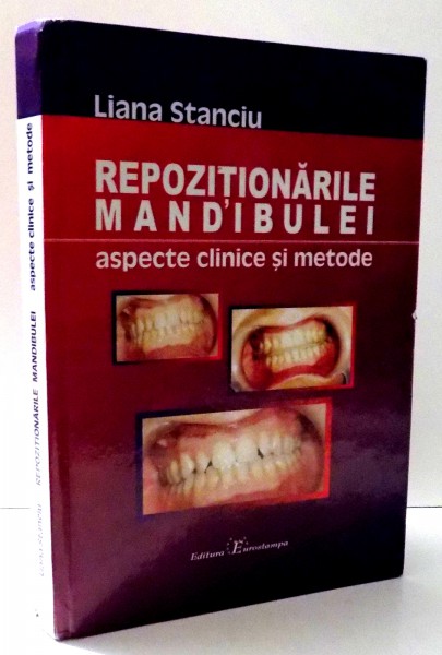 REPOZITIONARILE MANDIBULEI de LIANA STANCIU , 2009 , DEDICATIE*